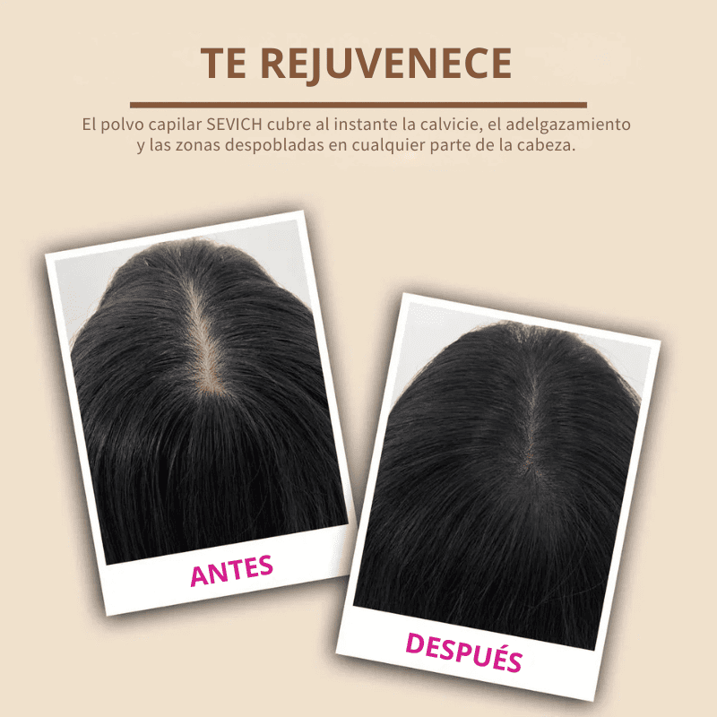Sevich – Camuflaje Capilar Instantáneo | Acabado Profesional